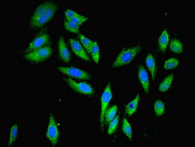 PARP3 Antibody (aa294-533)