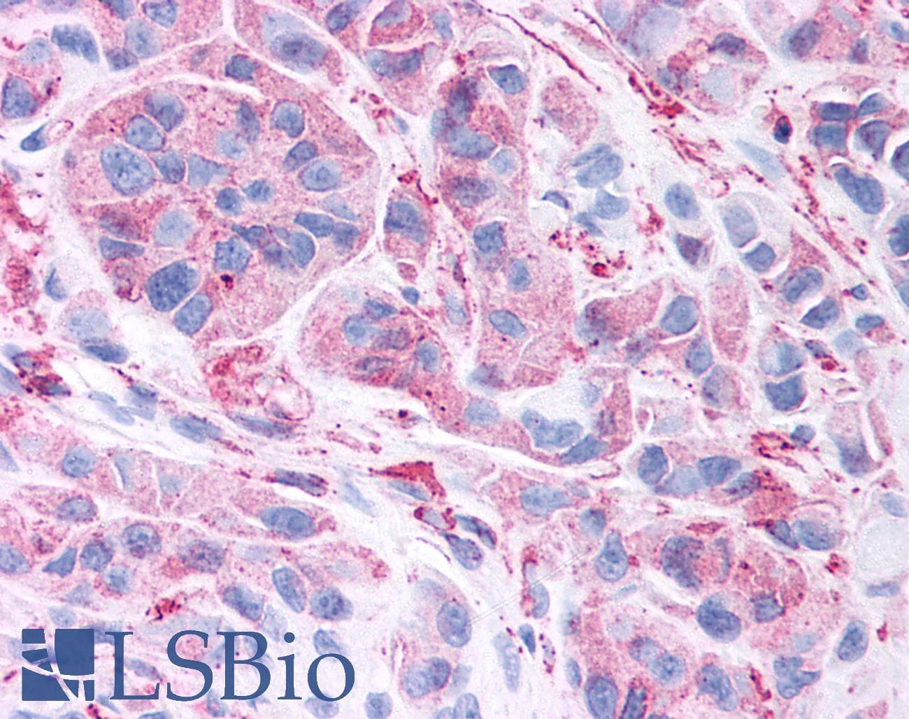 IHC-plus™ WNT5B Antibody (Internal)