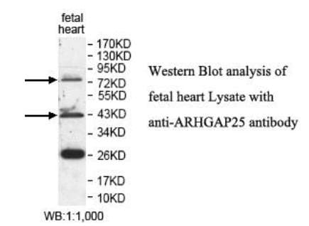 ARHGAP25 Antibody (aa189-367)