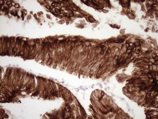 Monoclonal Mouse anti-Human KRT19 / CK19 / Cytokeratin 19 Antibody (clone OTI6A8, aa240-390, IHC, WB)