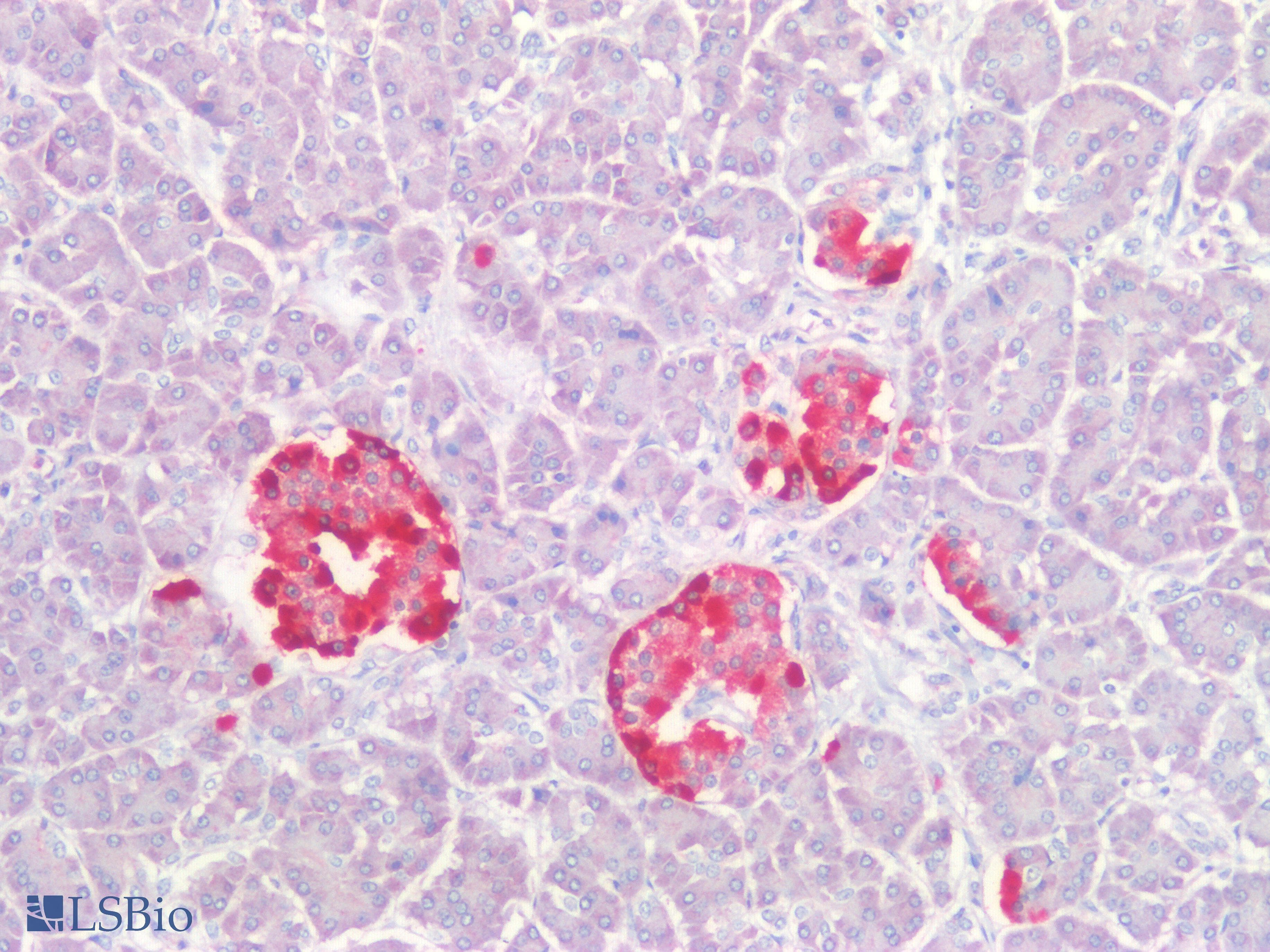 PathPlus™ CHGA / Chromogranin A Antibody