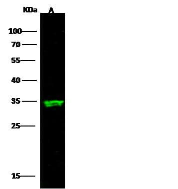 NAA10 / ARD1A Antibody (clone 10, Preservative Free)