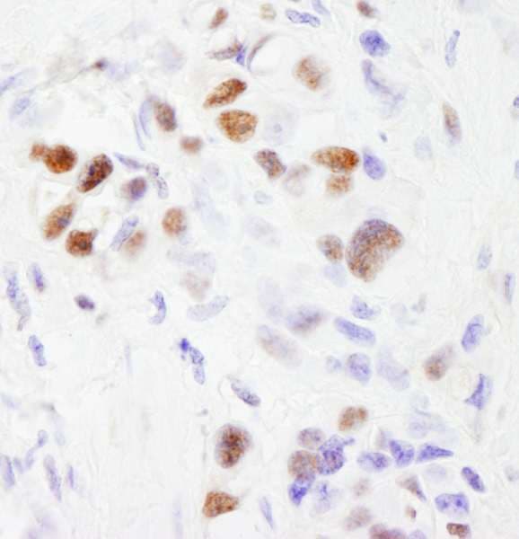 Polyclonal Rabbit anti-Human SF3B2 Antibody (aa825-872, IHC, WB)