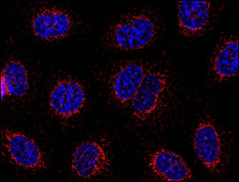 IHC-plus™ GOK / STIM1 Antibody (C-Terminus, clone CDN3H4)