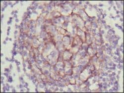 Monoclonal Mouse anti-Human NTRK3 / TRKC Antibody (clone 7H6, Amino Acid: 32-429, IHC, WB)