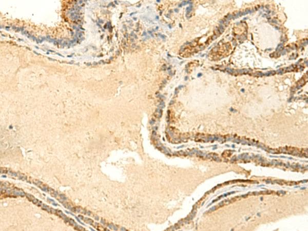 NTAN1 / PNAD Antibody