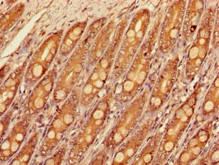 SLC16A9 Antibody
