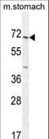 ESCO2 Antibody (aa132-161)