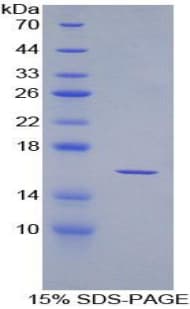 Rat Osteoglycin / Mimecan Protein (Recombinant His)