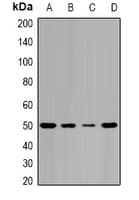 Polyclonal Rabbit anti-Human TIP49 / RUVBL1 Antibody (IHC, IF, WB)