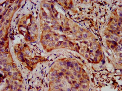 SHANK2 / SHANK Antibody