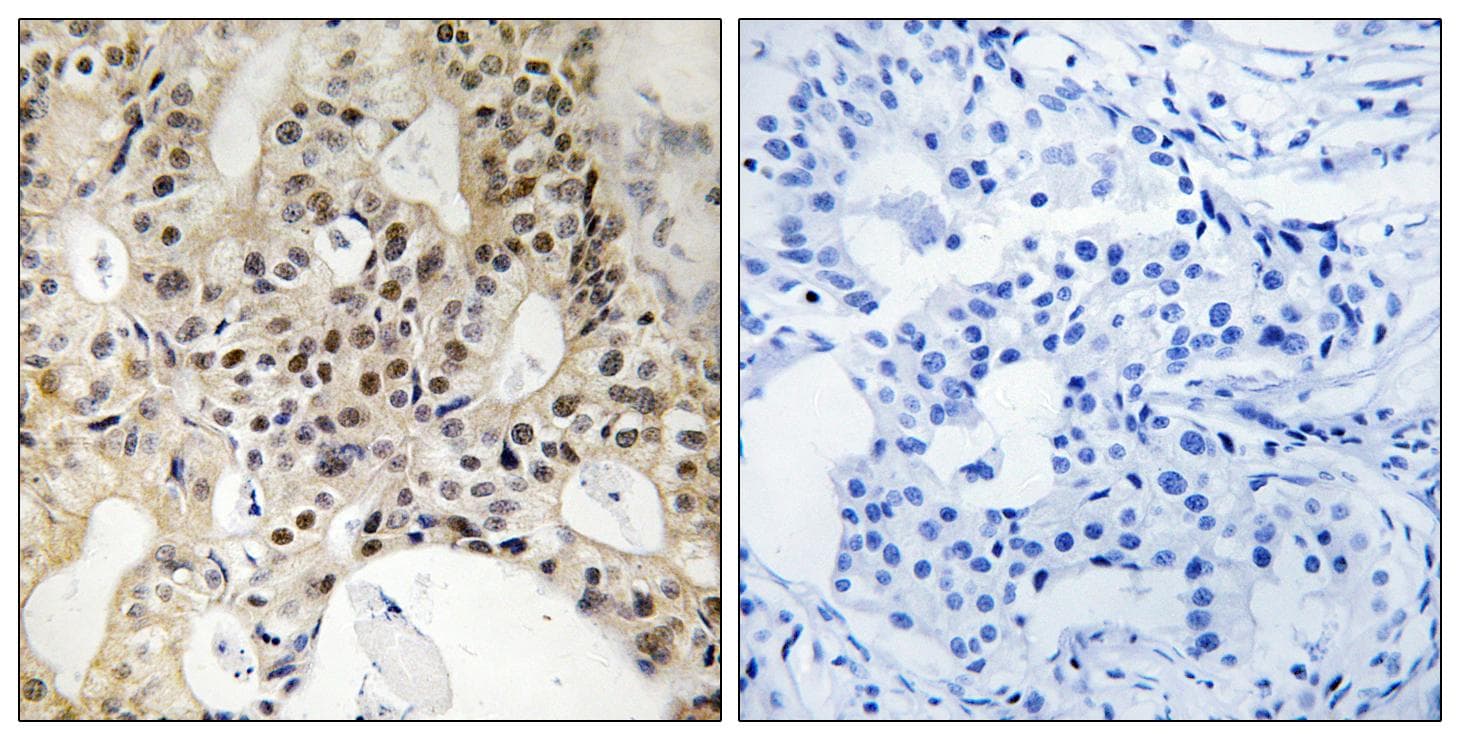 Polyclonal Rabbit anti-Human LATS1 + LATS2 Antibody (Ab-1079/1041, IHC)