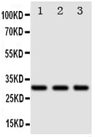 TNFRSF10A / DR4 Antibody (aa110-125)
