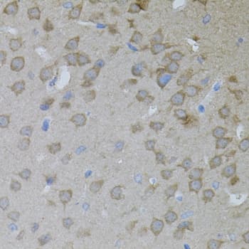 Polyclonal Rabbit anti-Human ARF1 Antibody (IHC, WB)