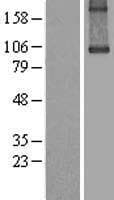 Human TGM1 / Transglutaminase Protein (Over-Expression Lysate Myc-DDK (Flag))
