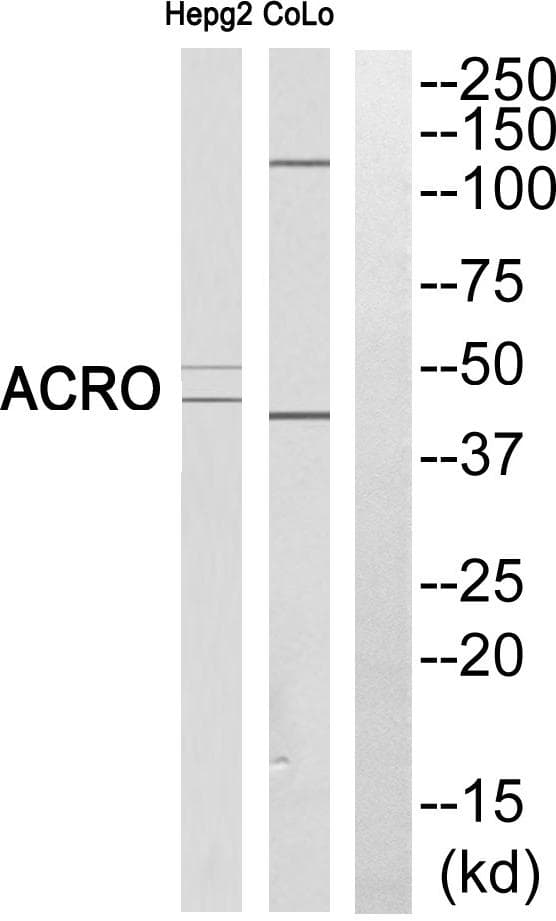 Acrosin Antibody (heavy chain, Cleaved-Ile43)