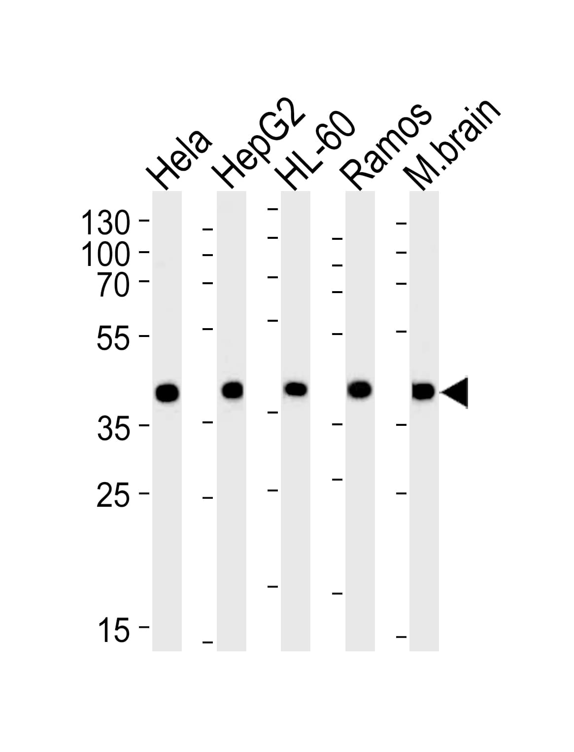 Polyclonal Rabbit anti-Human GOT2 Antibody (aa33-61, WB)