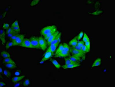 Polyclonal Rabbit anti-Human IMPDH2 Antibody (IHC, WB)