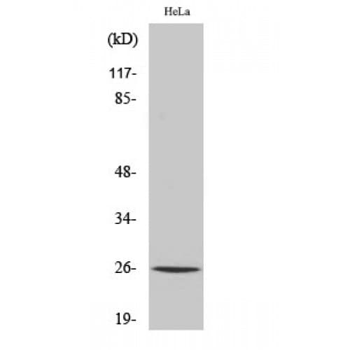 CMPK / CMPK1 Antibody (10-90 aa, N-terminal)