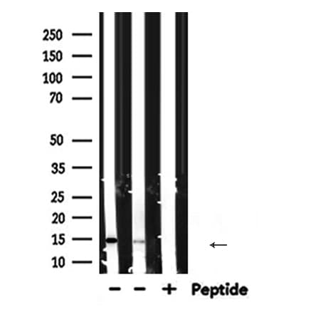 PFN1 / Profilin 1 Antibody