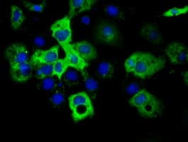 IGF2BP2 Antibody (clone OTI4D10)
