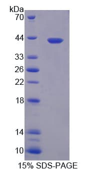 Rat NFKB1 / NF-Kappa-B Protein (Recombinant His-GST)