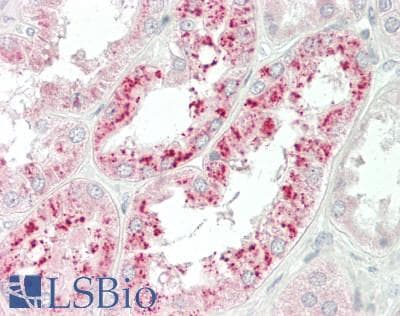 IHC-plus™ CTC1 Antibody (aa767-795)