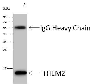 Polyclonal Rabbit anti-Human ACOT13 / THEM2 Antibody (Preservative Free, IHC, WB)