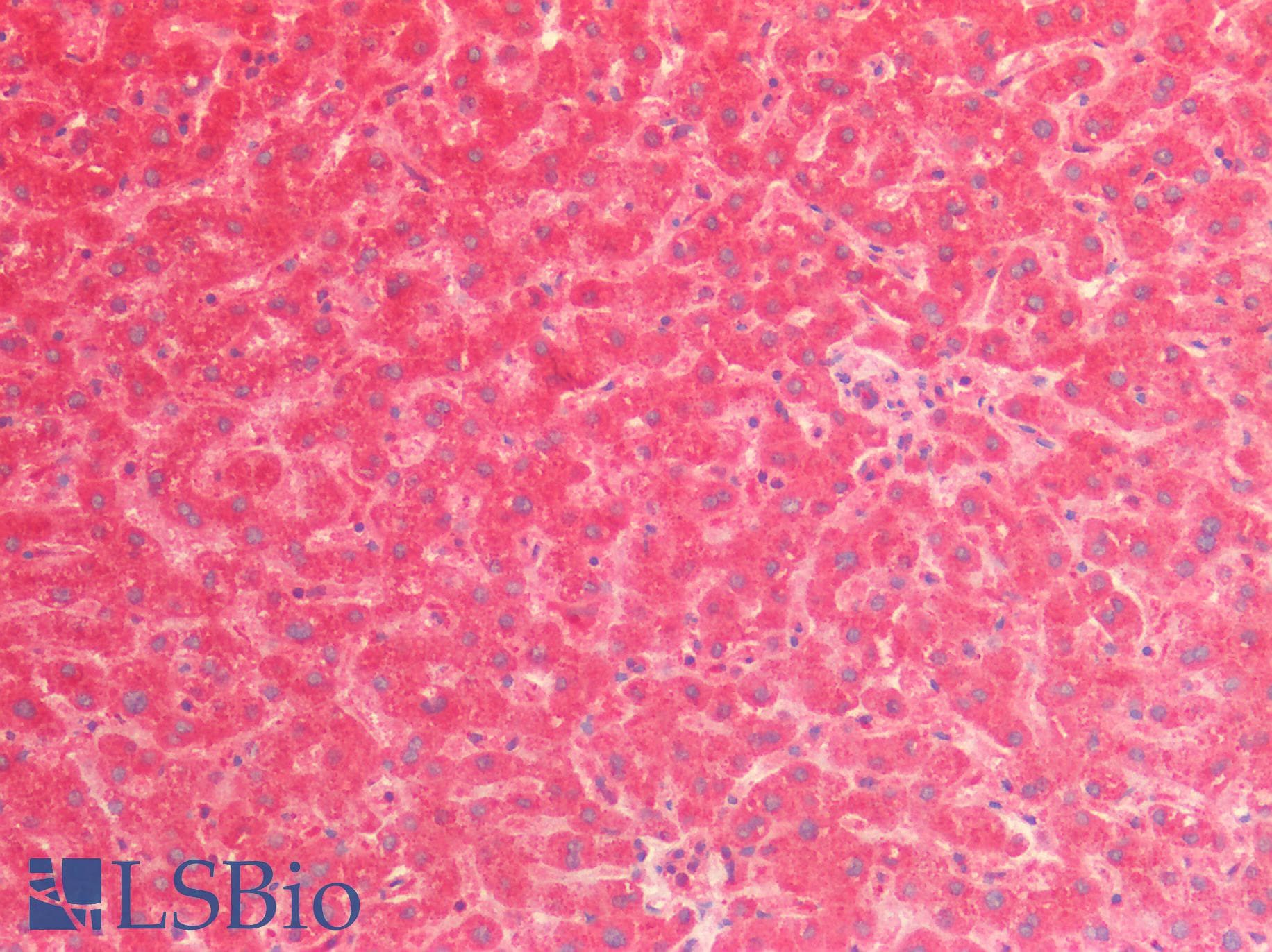 IHC-plus™ Polyclonal Rabbit anti-Human CTSV / Cathepsin V Antibody (aa105-334, IHC, WB)