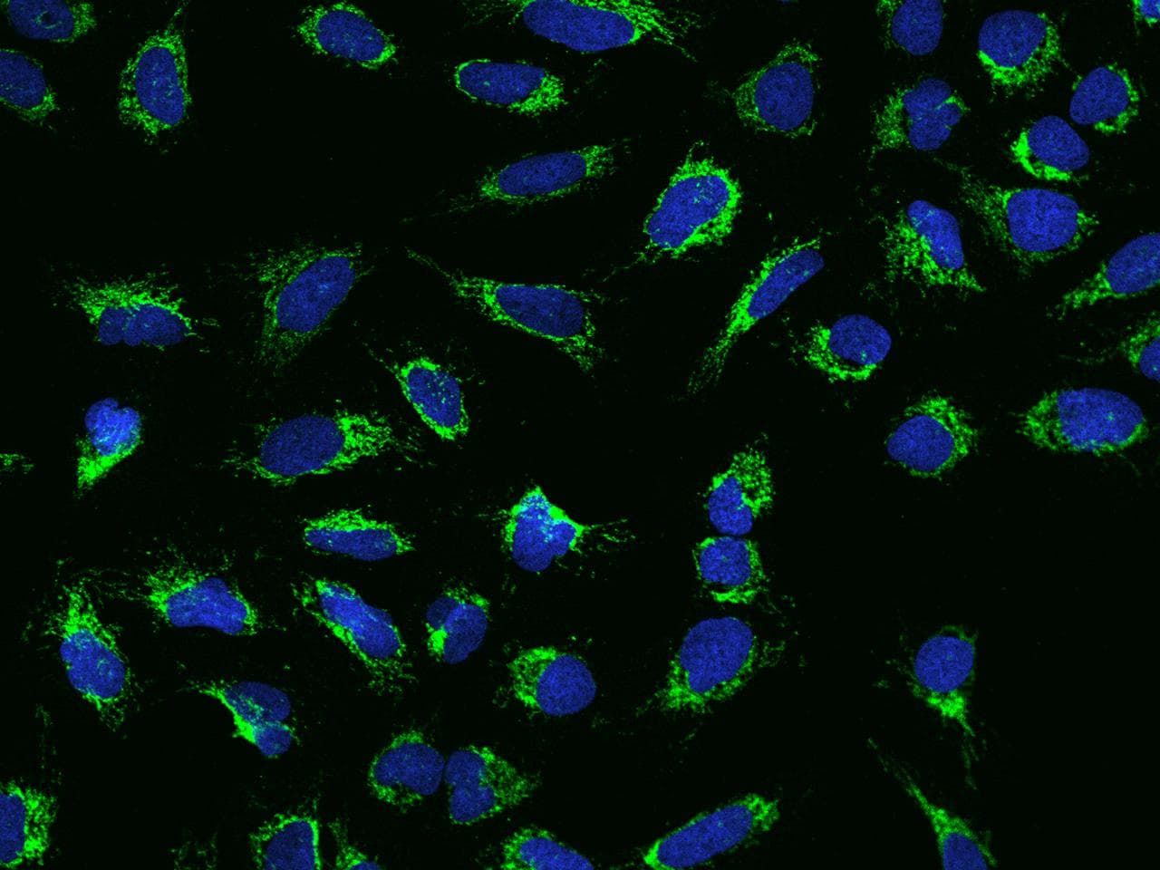 MYL3 Antibody