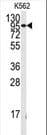 Polyclonal Rabbit anti-Human FGFR1 / FGF Receptor 1 Antibody (Tyr154, WB)