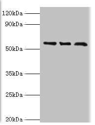 Polyclonal Rabbit anti-Human TBL1XR1 / TBLR1 Antibody (aa1-180, IHC, WB)