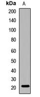 CRYGC / CCL Antibody