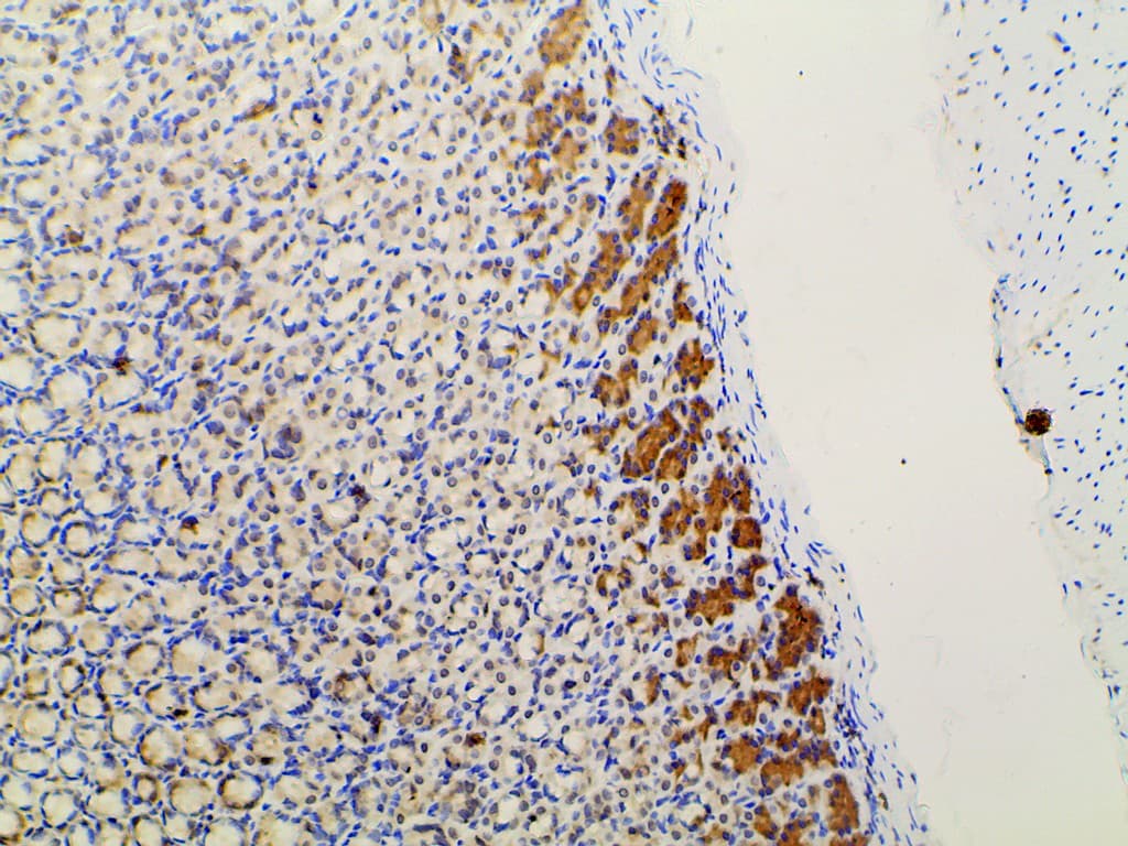 PIK3R1 / p85 Alpha Antibody (phospho-Tyr607)