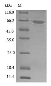 Human DHX9 Protein (Recombinant 10His, N-terminus)