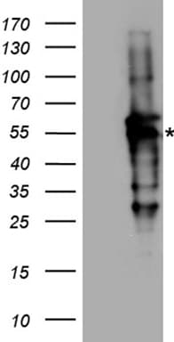 RAD52 Antibody