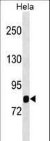 Polyclonal Rabbit anti-Human MASP1 / MASP Antibody (aa481-507, WB)