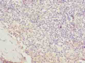 Polyclonal Rabbit anti-Human C4orf37 Antibody (IHC, WB)