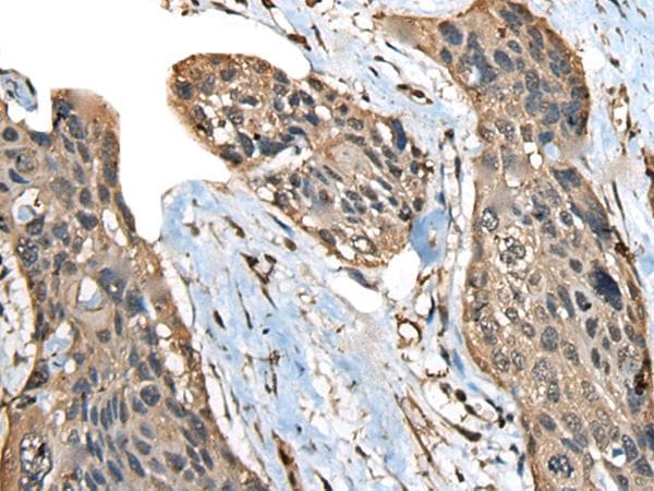 ATXN3 / JOS Antibody