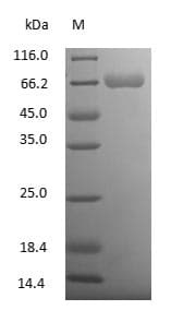 ALB / Serum Albumin Protein (Native)