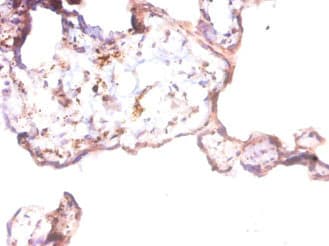ANGPT1 / Angiopoietin-1 Antibody