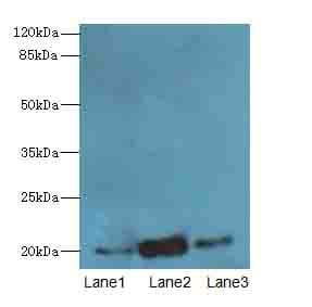 TPRKB Antibody