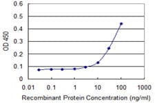 GLRA1/Glycine Receptor Alpha 1 Antibody (clone 2E6)