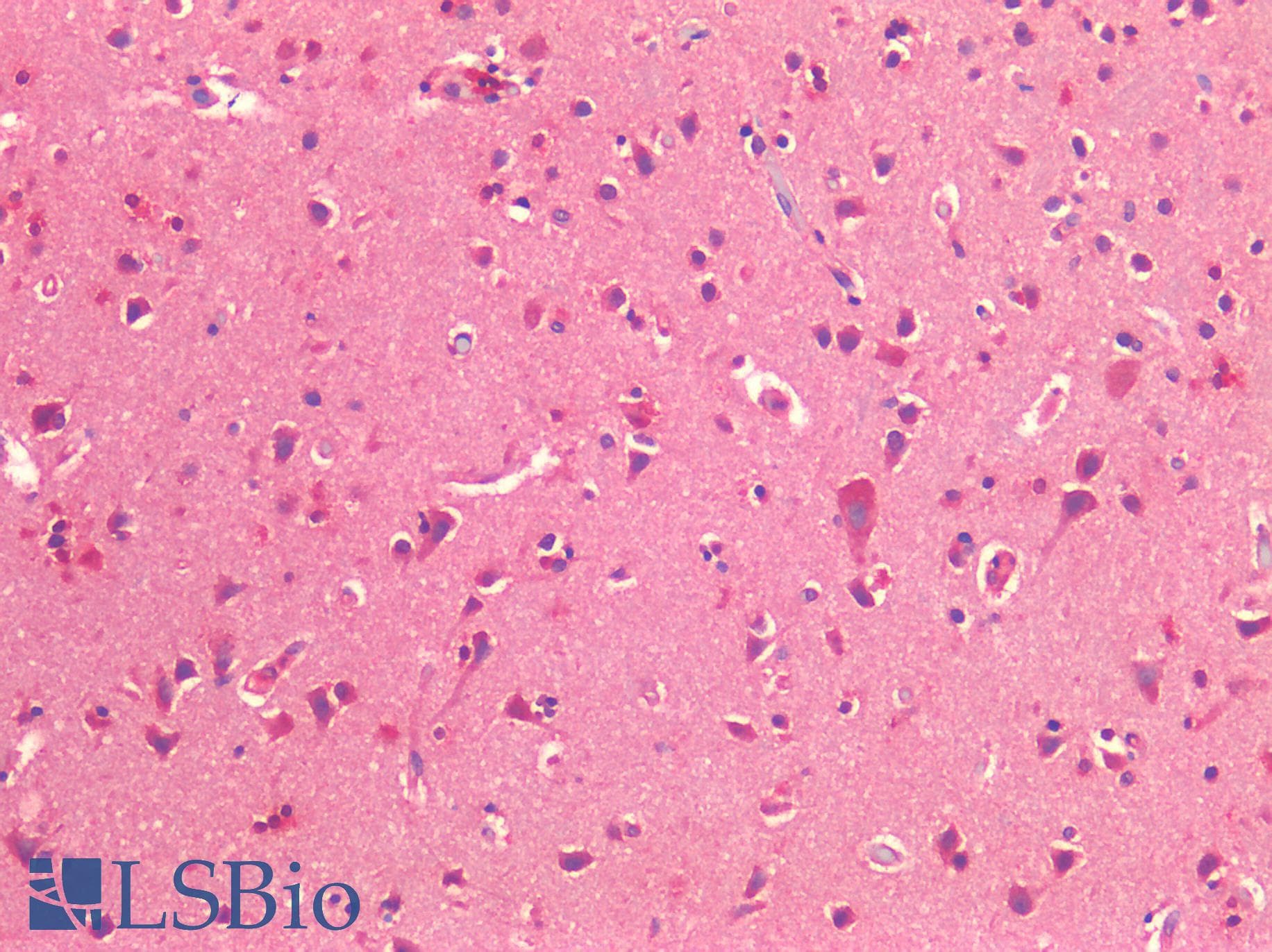 IHC-plus™ Polyclonal Rabbit anti-Human ROR1 Antibody (C-terminal, IHC)