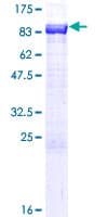 Human NPLOC4 Protein (Recombinant GST)