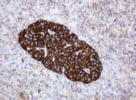 CD99 Antibody (clone OTI5C8)
