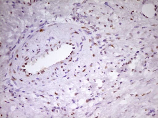 MEF2D Antibody (aa1-282, clone OTI1E11, Carrier-free)
