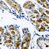 AK2 / Adenylate Kinase 2 Antibody