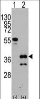 IHC-plus™ Polyclonal Rabbit anti-Human ZIC4 Antibody (aa299-334, IHC, WB)