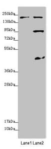 Polyclonal Rabbit anti-Human MYO5B / Myosin VB Antibody (IHC, WB)